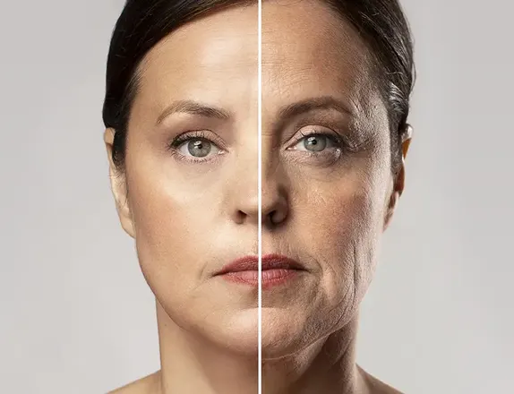 Rosto feminino comparando antes e depois do facelifting